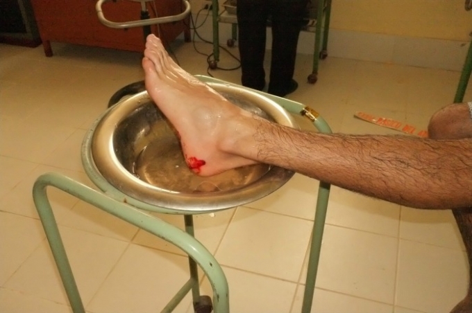 Advierte Isssteson por picadura de mantarraya el chiltepin